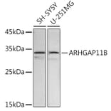 Western Blot - Anti-ARHGAP11B Antibody (A91855) - Antibodies.com