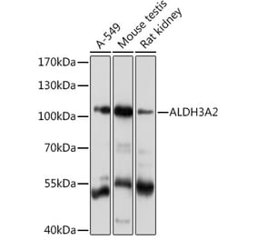 Western Blot - Anti-Aldehyde dehydrogenase 10 Antibody (A91857) - Antibodies.com
