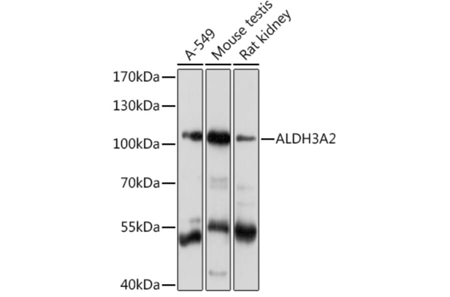 Western Blot - Anti-Aldehyde dehydrogenase 10 Antibody (A91857) - Antibodies.com