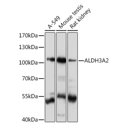 Western Blot - Anti-Aldehyde dehydrogenase 10 Antibody (A91857) - Antibodies.com