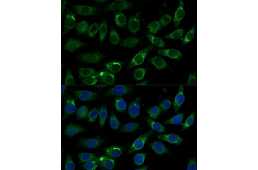 Immunofluorescence - Anti-Aldehyde dehydrogenase 10 Antibody (A91857) - Antibodies.com
