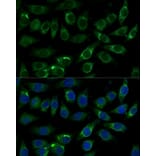 Immunofluorescence - Anti-Aldehyde dehydrogenase 10 Antibody (A91857) - Antibodies.com