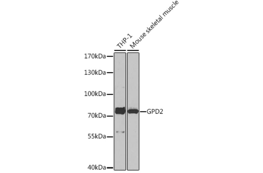 Western Blot - Anti-GPD2 Antibody (A91858) - Antibodies.com