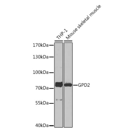 Western Blot - Anti-GPD2 Antibody (A91858) - Antibodies.com