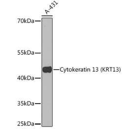 Western Blot - Anti-Cytokeratin 13 Antibody (A91859) - Antibodies.com