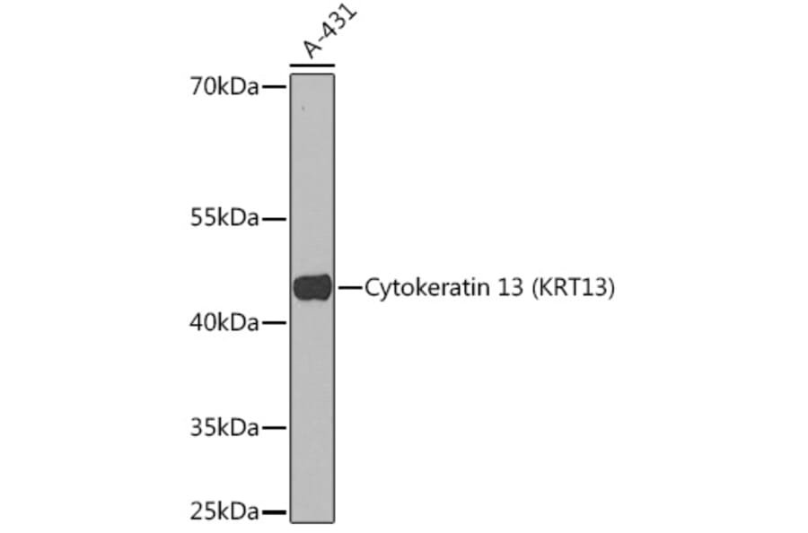 Western Blot - Anti-Cytokeratin 13 Antibody (A91859) - Antibodies.com