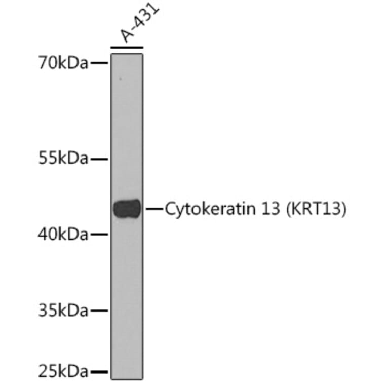 Western Blot - Anti-Cytokeratin 13 Antibody (A91859) - Antibodies.com