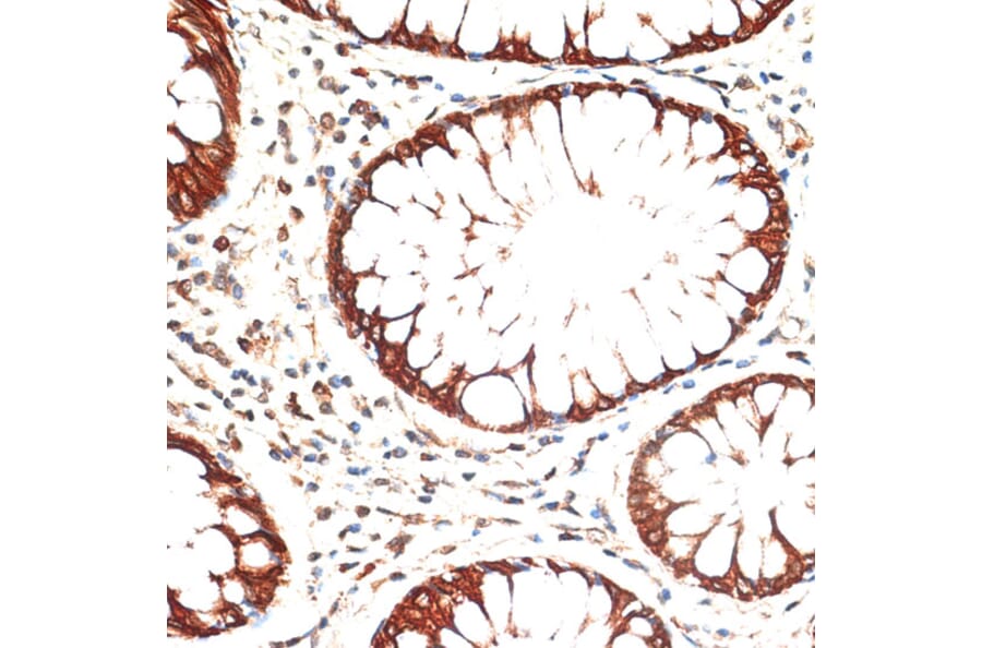 Immunohistochemistry - Anti-Cytokeratin 13 Antibody (A91859) - Antibodies.com