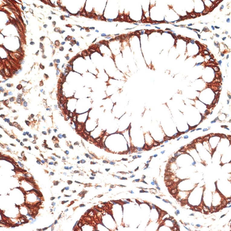 Immunohistochemistry - Anti-Cytokeratin 13 Antibody (A91859) - Antibodies.com
