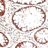 Immunohistochemistry - Anti-Cytokeratin 13 Antibody (A91859) - Antibodies.com