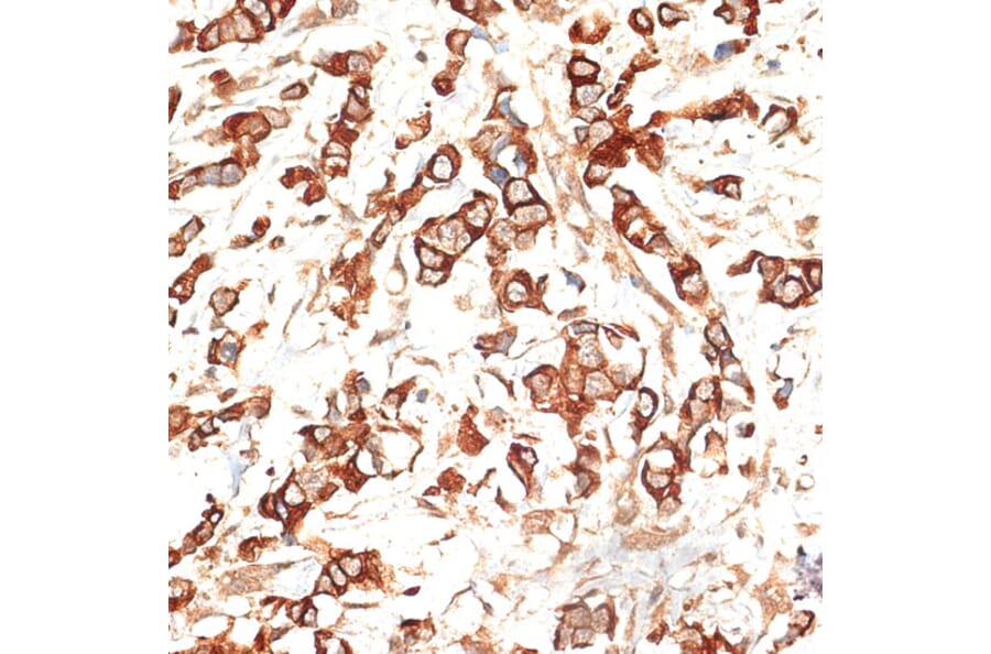 Immunohistochemistry - Anti-Cytokeratin 13 Antibody (A91859) - Antibodies.com