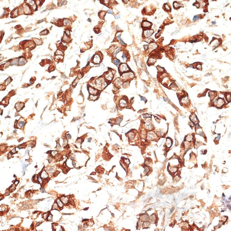Immunohistochemistry - Anti-Cytokeratin 13 Antibody (A91859) - Antibodies.com