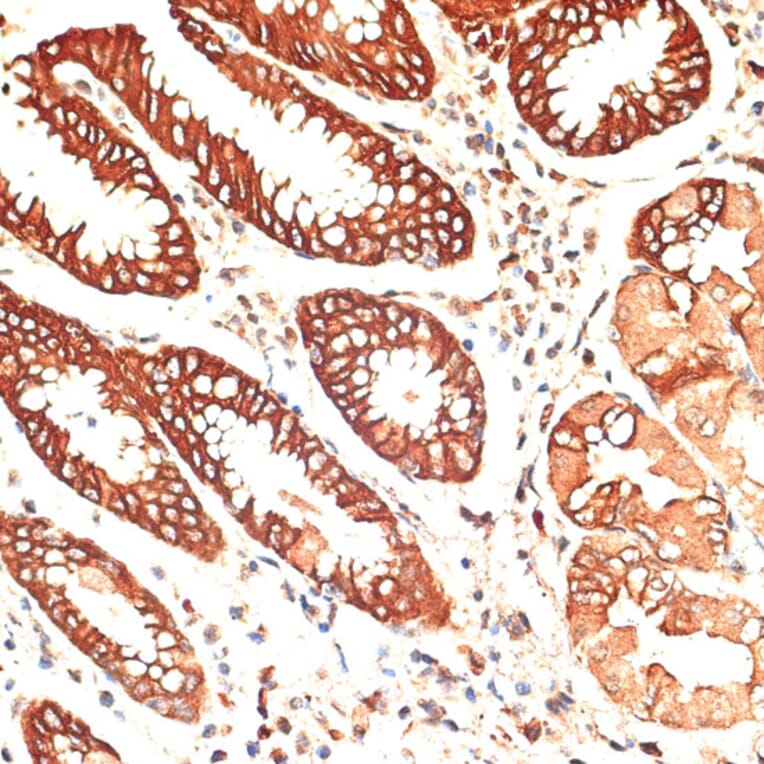 Immunohistochemistry - Anti-Cytokeratin 13 Antibody (A91859) - Antibodies.com