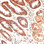 Immunohistochemistry - Anti-Cytokeratin 13 Antibody (A91859) - Antibodies.com