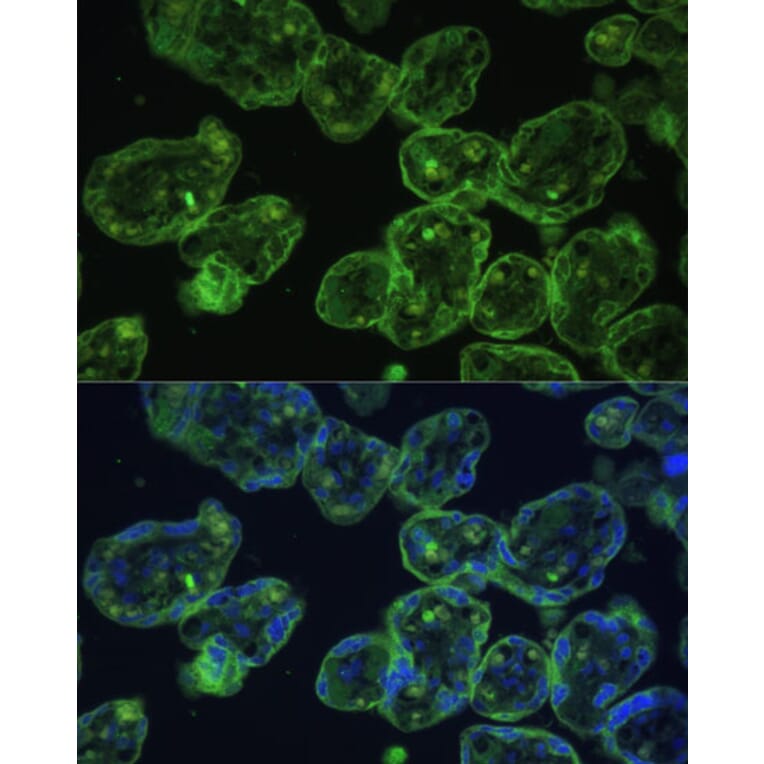 Immunofluorescence - Anti-Cytokeratin 13 Antibody (A91859) - Antibodies.com