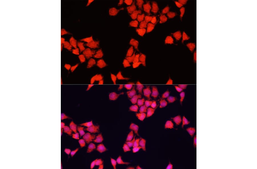 Immunofluorescence - Anti-FXR1 Antibody (A91863) - Antibodies.com