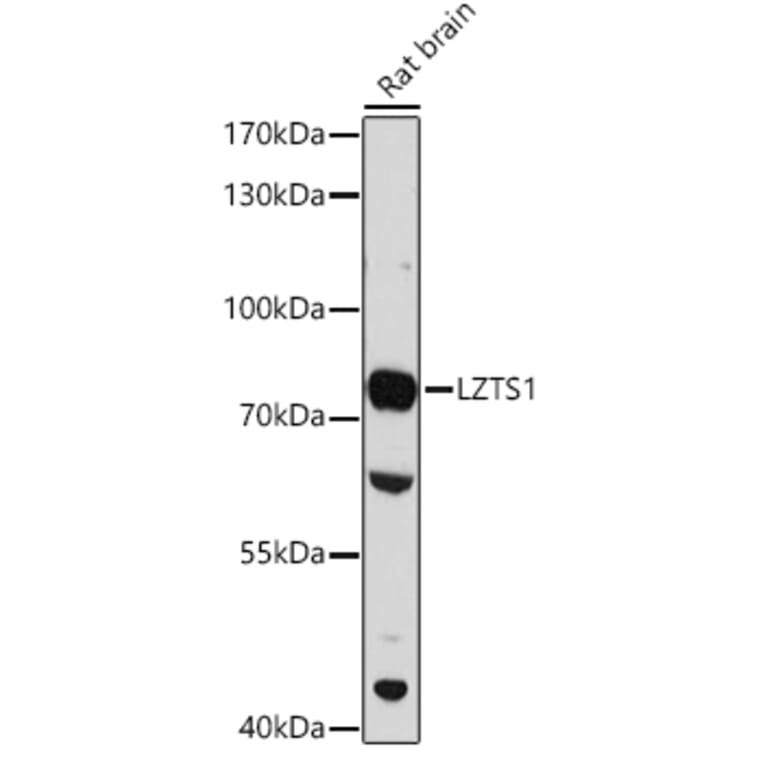 Western Blot - Anti-LZTS1/FEZ1 Antibody (A91864) - Antibodies.com