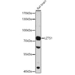 Western Blot - Anti-LZTS1/FEZ1 Antibody (A91864) - Antibodies.com