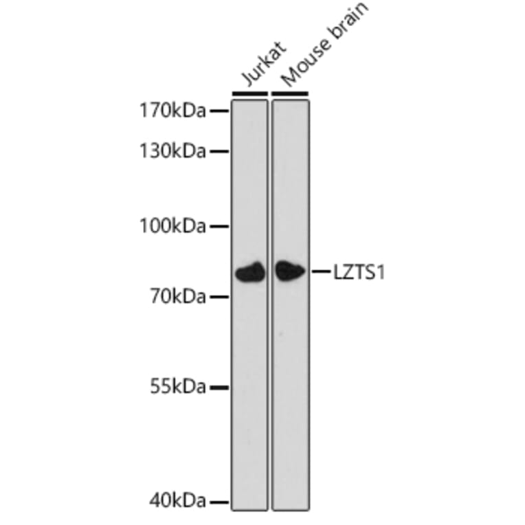Western Blot - Anti-LZTS1/FEZ1 Antibody (A91864) - Antibodies.com