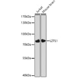 Western Blot - Anti-LZTS1/FEZ1 Antibody (A91864) - Antibodies.com