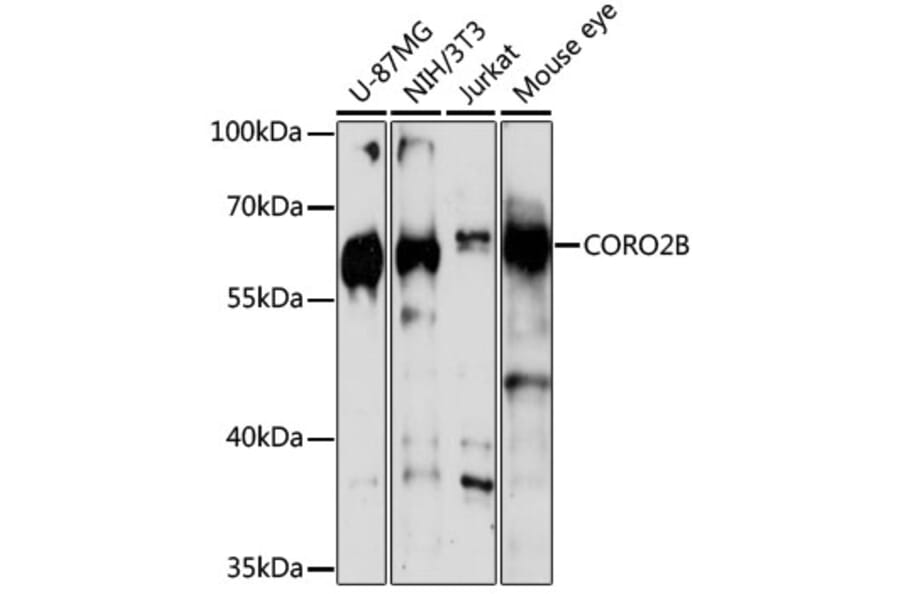 Western Blot - Anti-CORO2B Antibody (A16670) - Antibodies.com
