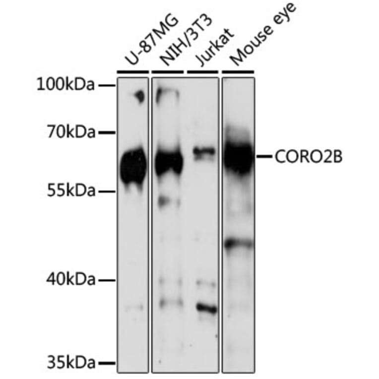 Western Blot - Anti-CORO2B Antibody (A16670) - Antibodies.com