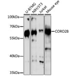 Western Blot - Anti-CORO2B Antibody (A16670) - Antibodies.com