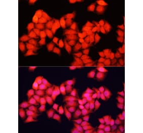 Immunofluorescence - Anti-A-Raf Antibody (A91866) - Antibodies.com