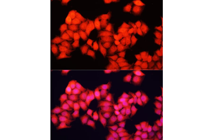 Immunofluorescence - Anti-A-Raf Antibody (A91866) - Antibodies.com