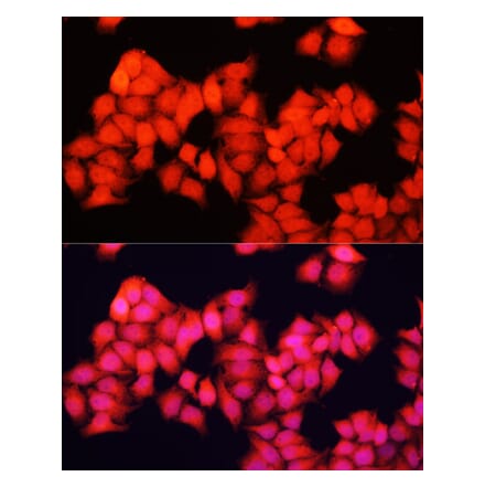 Immunofluorescence - Anti-A-Raf Antibody (A91866) - Antibodies.com