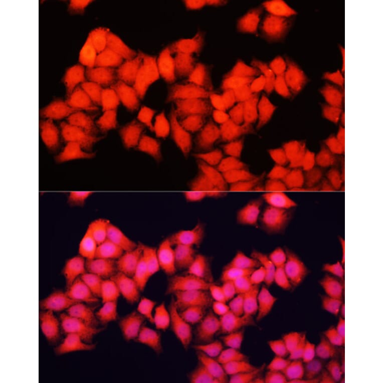 Immunofluorescence - Anti-A-Raf Antibody (A91866) - Antibodies.com