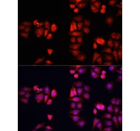 Immunofluorescence - Anti-BMP1 Antibody (A91879) - Antibodies.com