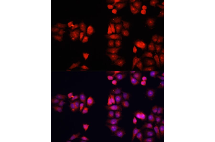 Immunofluorescence - Anti-BMP1 Antibody (A91879) - Antibodies.com