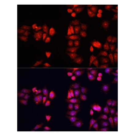 Immunofluorescence - Anti-BMP1 Antibody (A91879) - Antibodies.com