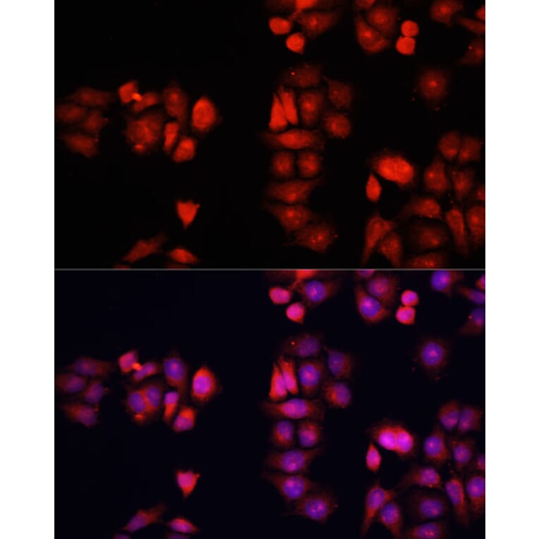 Immunofluorescence - Anti-BMP1 Antibody (A91879) - Antibodies.com