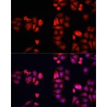 Immunofluorescence - Anti-BMP1 Antibody (A91879) - Antibodies.com