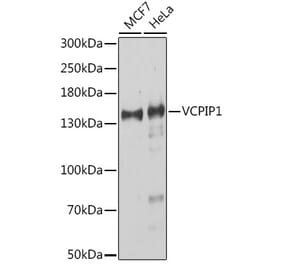 Western Blot - Anti-VCIP 135 Antibody (A91881) - Antibodies.com