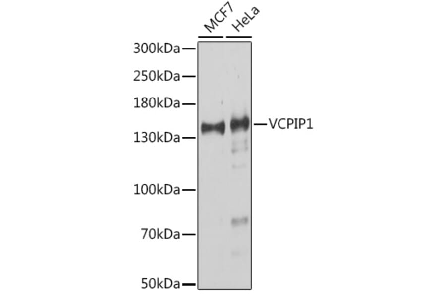 Western Blot - Anti-VCIP 135 Antibody (A91881) - Antibodies.com