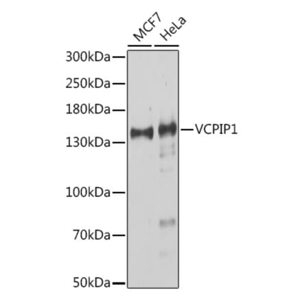 Western Blot - Anti-VCIP 135 Antibody (A91881) - Antibodies.com