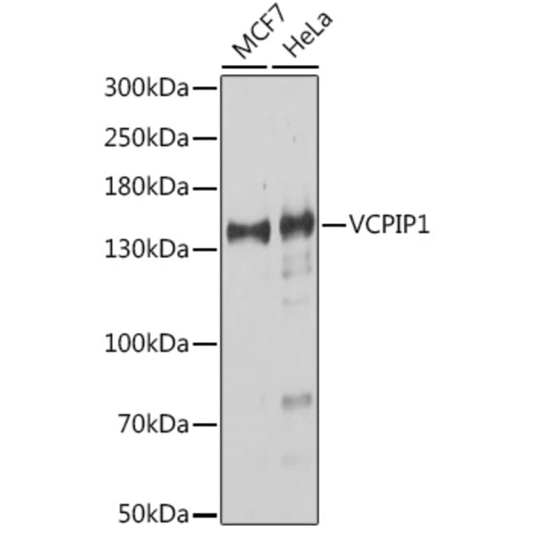 Western Blot - Anti-VCIP 135 Antibody (A91881) - Antibodies.com