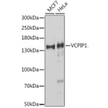 Western Blot - Anti-VCIP 135 Antibody (A91881) - Antibodies.com