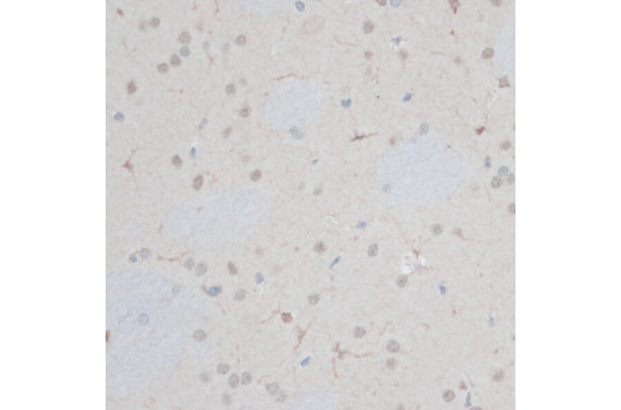 Immunohistochemistry - Anti-ZNF415 Antibody (A14913) - Antibodies.com