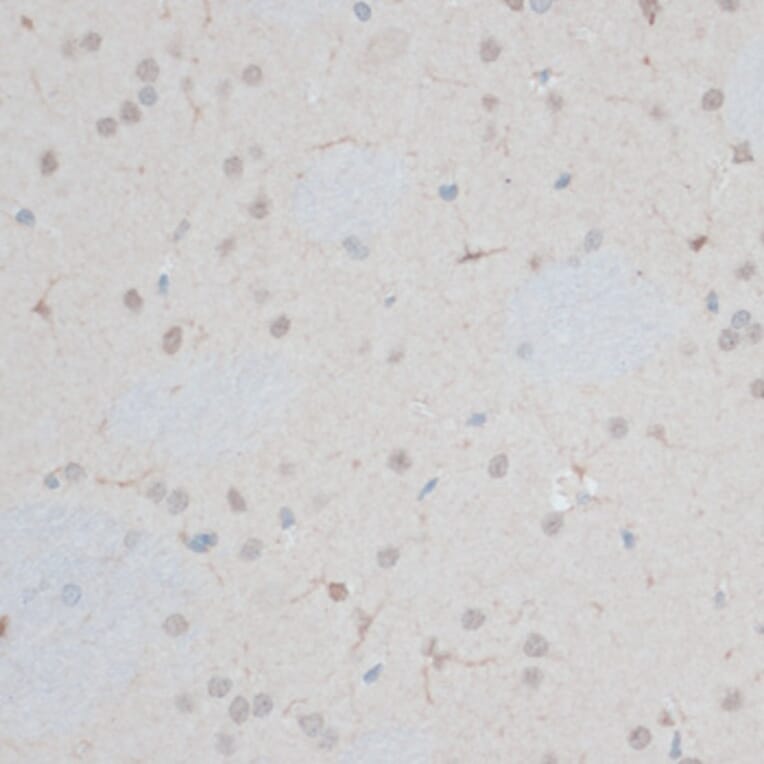 Immunohistochemistry - Anti-ZNF415 Antibody (A14913) - Antibodies.com