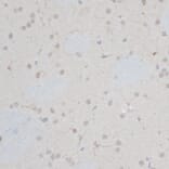 Immunohistochemistry - Anti-ZNF415 Antibody (A14913) - Antibodies.com