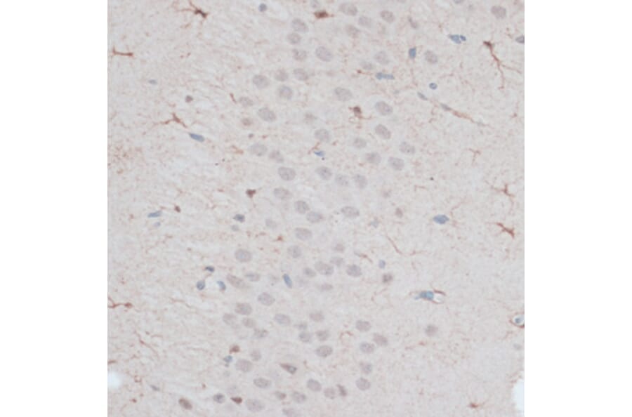 Immunohistochemistry - Anti-ZNF415 Antibody (A14913) - Antibodies.com
