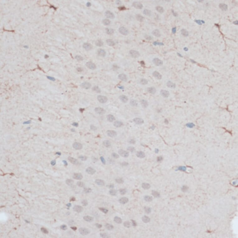 Immunohistochemistry - Anti-ZNF415 Antibody (A14913) - Antibodies.com