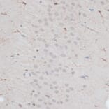 Immunohistochemistry - Anti-ZNF415 Antibody (A14913) - Antibodies.com