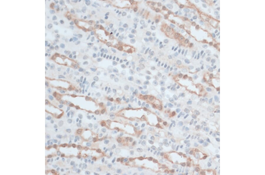 Immunohistochemistry - Anti-ZNF415 Antibody (A14913) - Antibodies.com