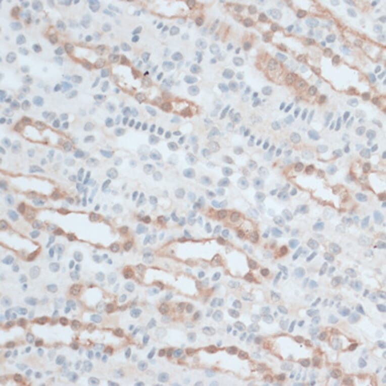 Immunohistochemistry - Anti-ZNF415 Antibody (A14913) - Antibodies.com