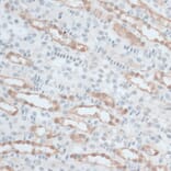 Immunohistochemistry - Anti-ZNF415 Antibody (A14913) - Antibodies.com